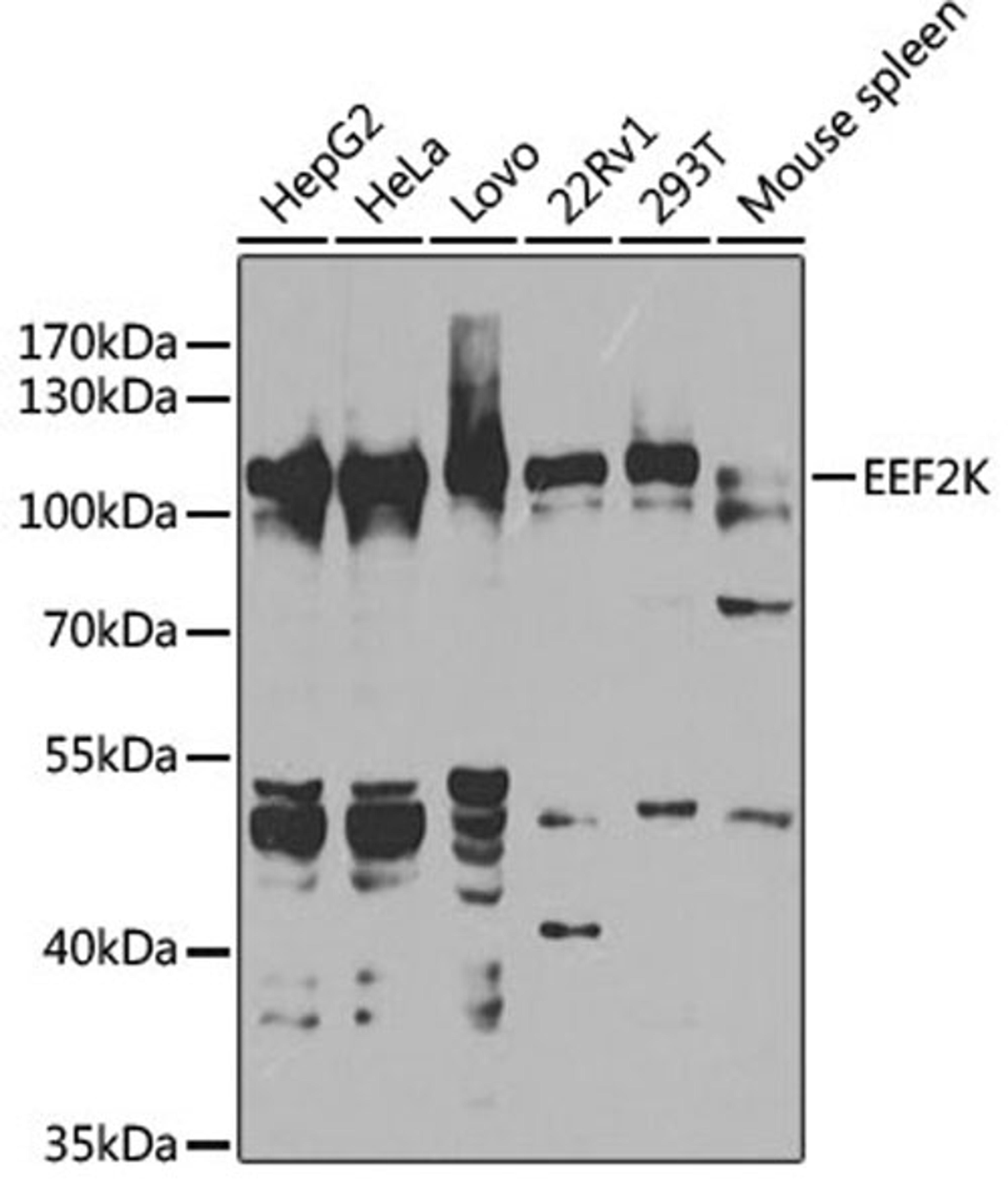 Western blot - EEF2K antibody (A5404)