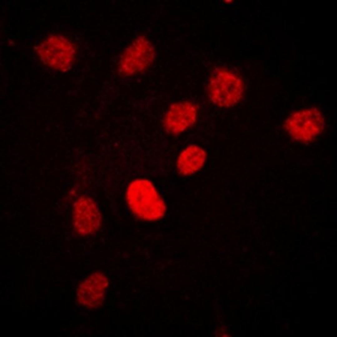 Immunofluorescense analysis of HEK293T cells using C/EBP beta (phospho-T235) antibody