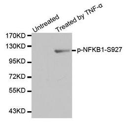 Western blot analysis of extracts from Hela cells using NFkB (Phospho-105-S927) antibody