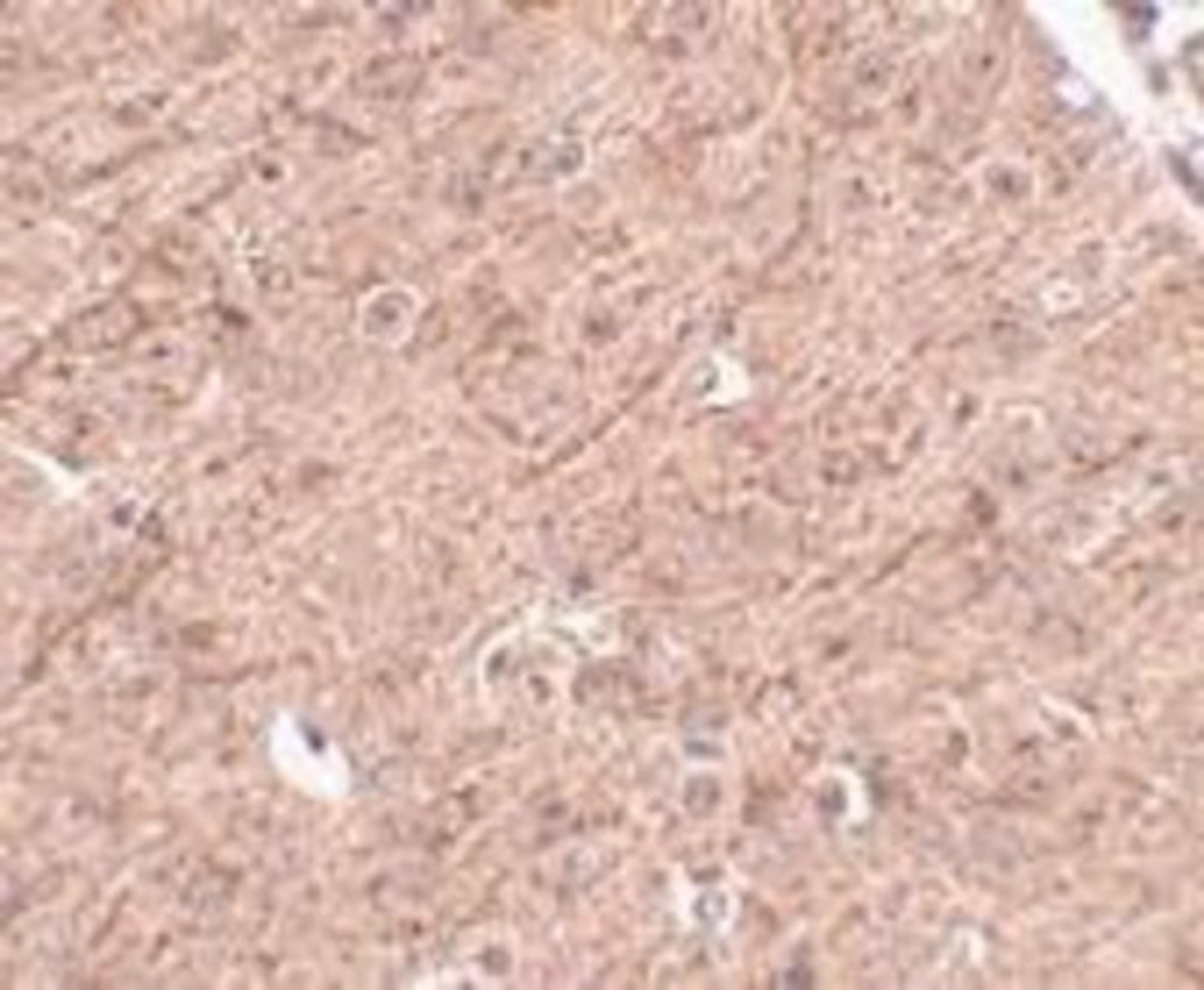 Immunohistochemistry-Paraffin: Lass5 Antibody [NBP1-76964] - Mouse brain tissue with LASS5 antibody at 2.5 ug/ml.