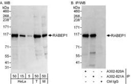 Detection of human and mouse RABEP1 by western blot (h&m) and immunoprecipitation (h).