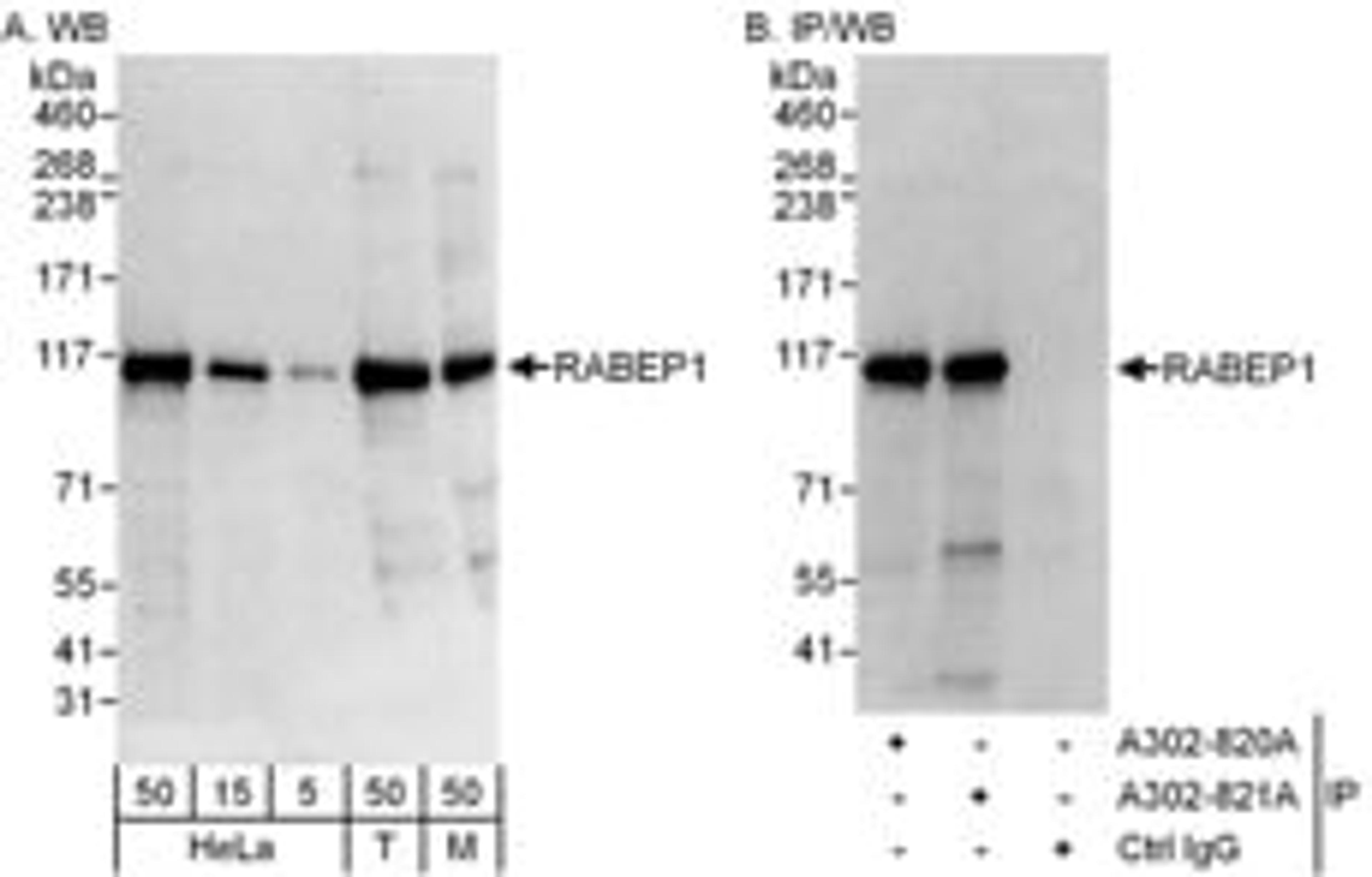 Detection of human and mouse RABEP1 by western blot (h&m) and immunoprecipitation (h).