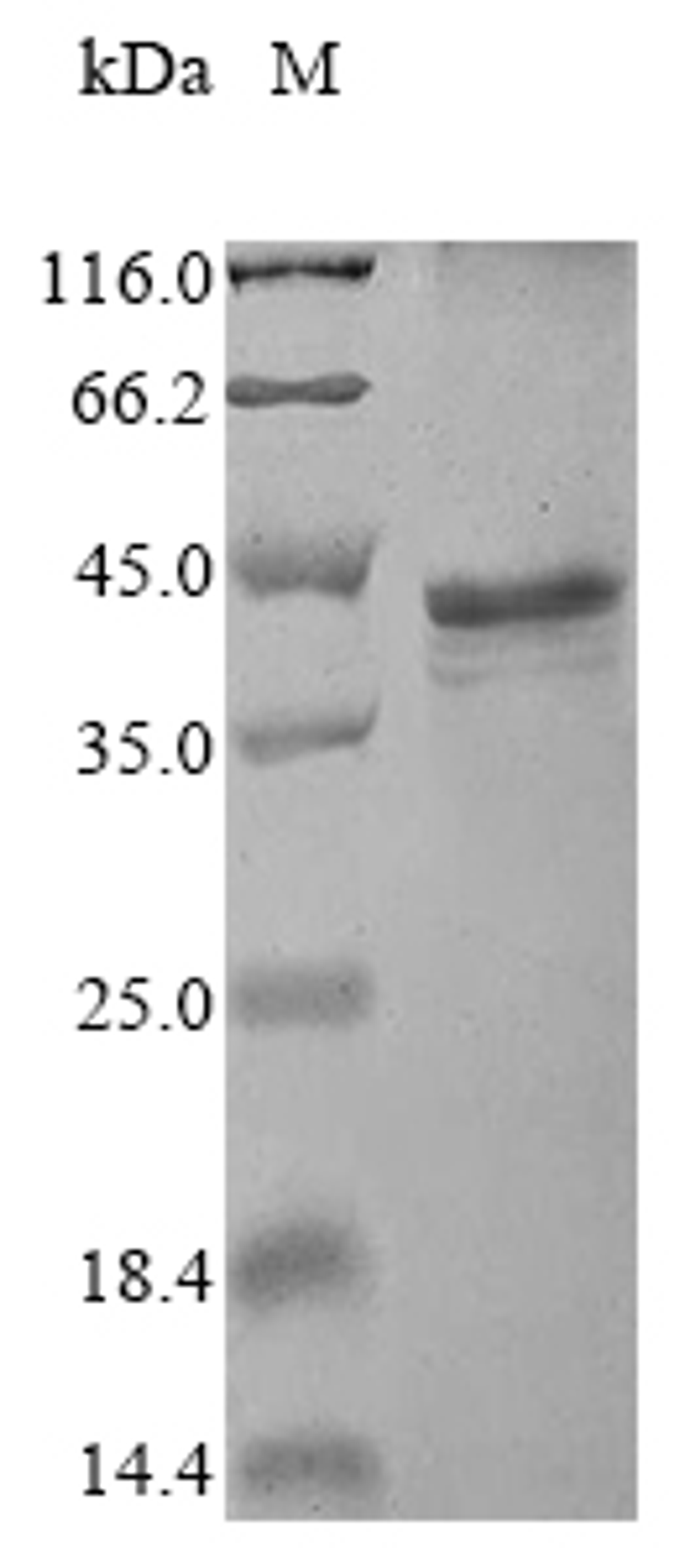 (Tris-Glycine gel) Discontinuous SDS-PAGE (reduced) with 5% enrichment gel and 15% separation gel.