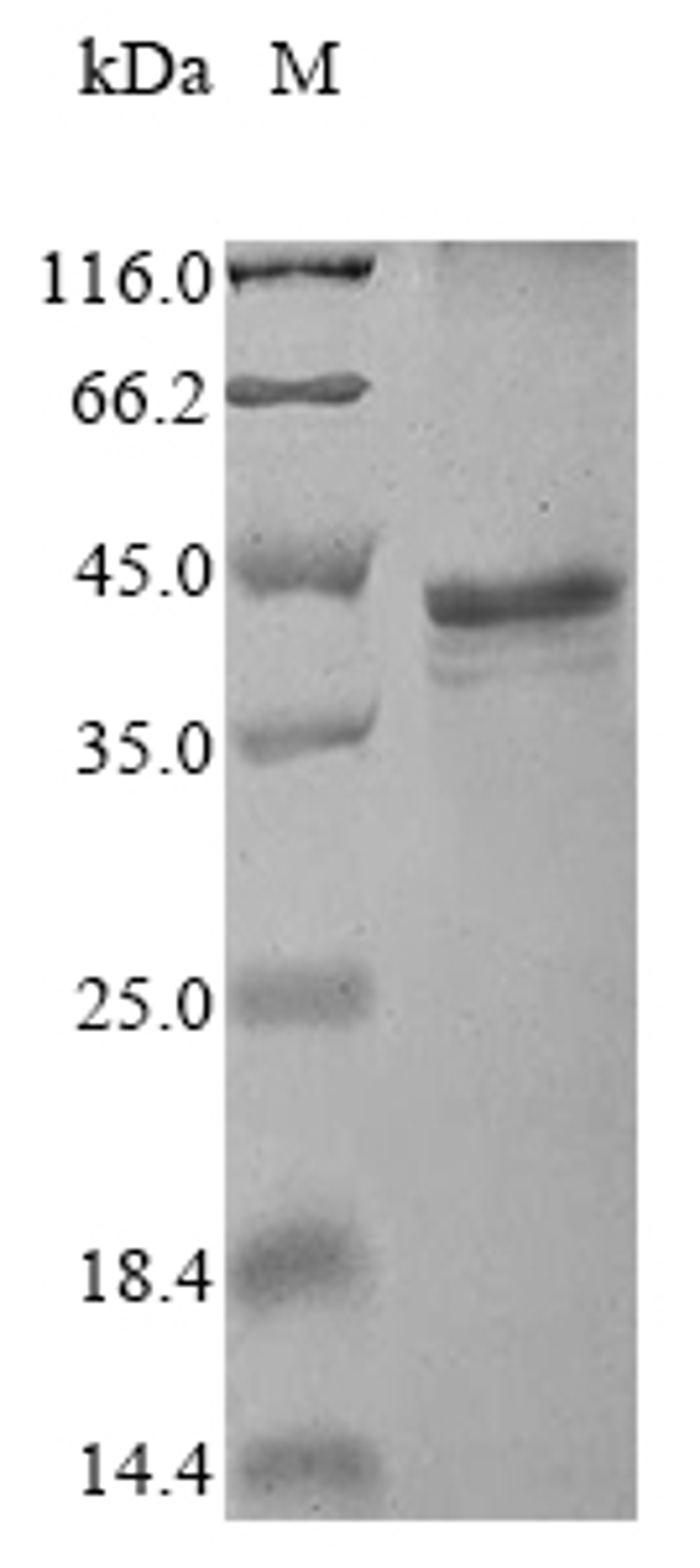 (Tris-Glycine gel) Discontinuous SDS-PAGE (reduced) with 5% enrichment gel and 15% separation gel.