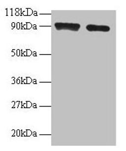 Western blot. All lanes: SAT1 antibody at 2µg/ml. Lane 1: 293T whole cell lysate. Lane 2: EC109 whole cell lysate. Secondary. Goat polyclonal to rabbit IgG at 1/15000 dilution. Predicted band size: 21 kDa. Observed band size: 90 kDa