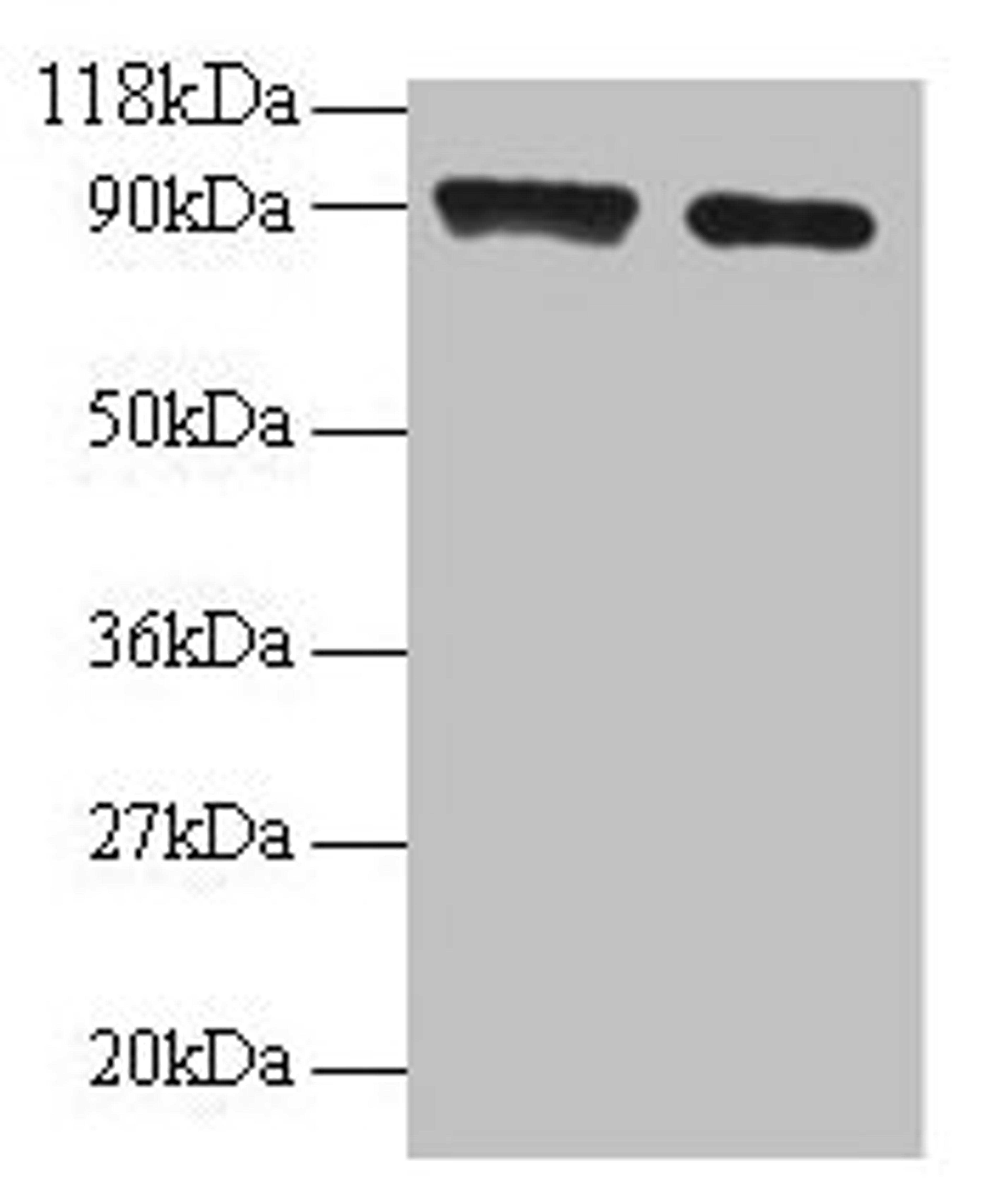 Western blot. All lanes: SAT1 antibody at 2µg/ml. Lane 1: 293T whole cell lysate. Lane 2: EC109 whole cell lysate. Secondary. Goat polyclonal to rabbit IgG at 1/15000 dilution. Predicted band size: 21 kDa. Observed band size: 90 kDa