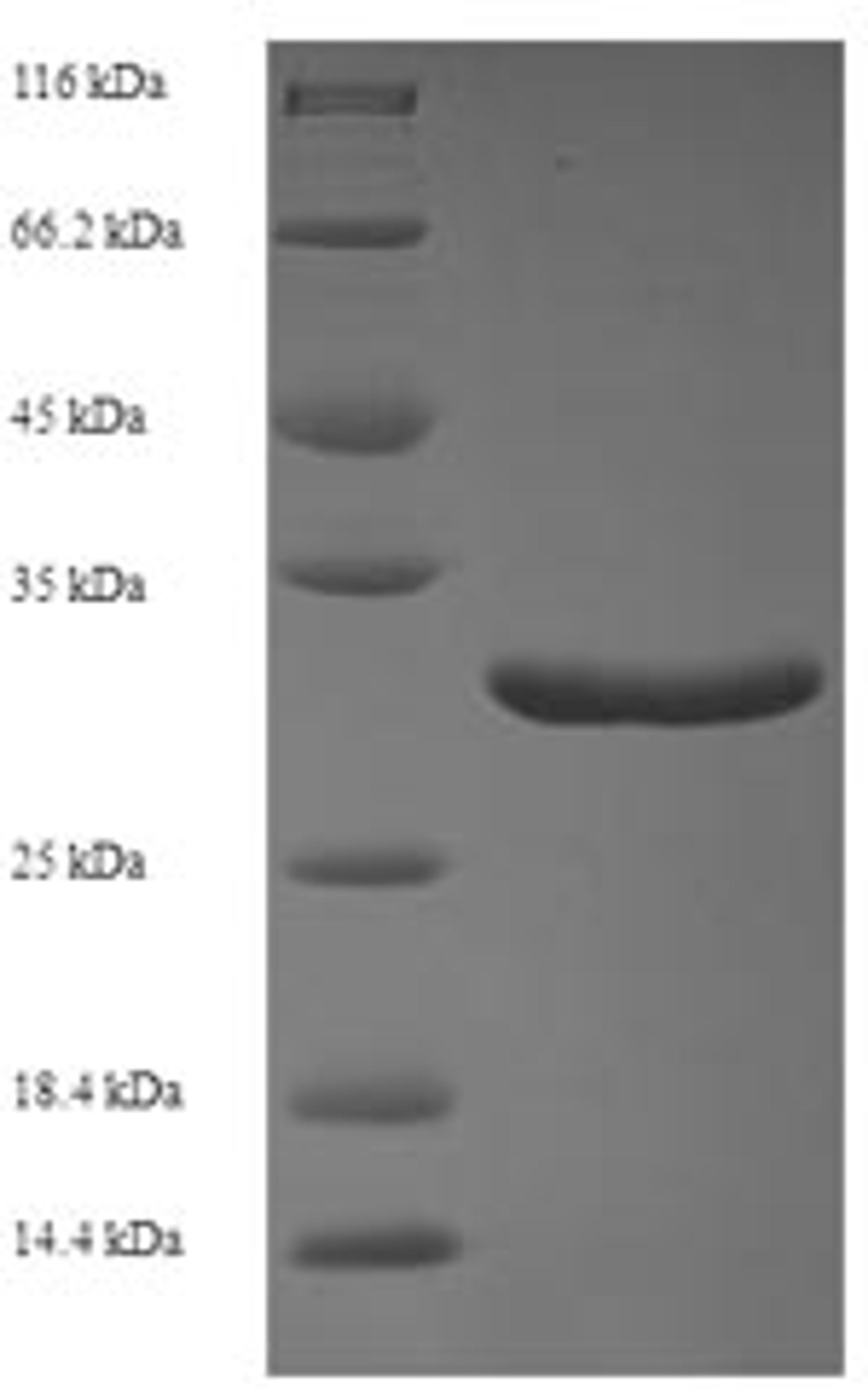 (Tris-Glycine gel) Discontinuous SDS-PAGE (reduced) with 5% enrichment gel and 15% separation gel.