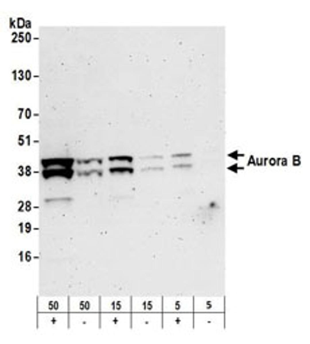 Detection of human Aurora B by western blot.