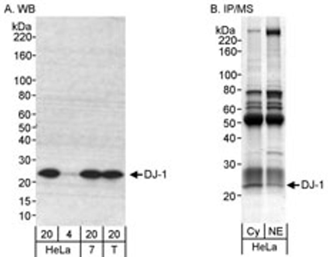 Detection of human DJ-1 by western blot and immunoprecipitation/Mass Spectrometry.