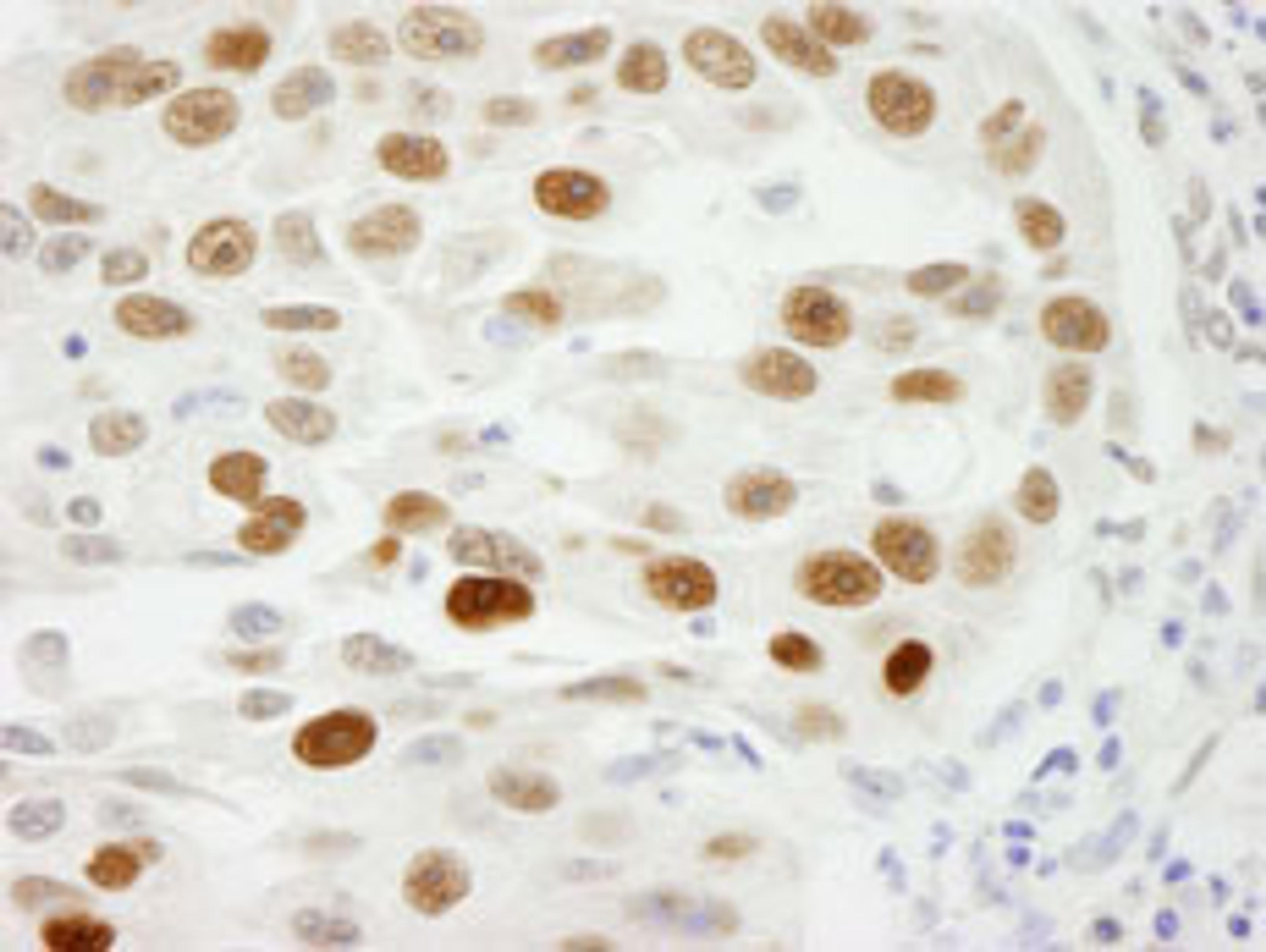 Detection of human RCH1 by immunohistochemistry.