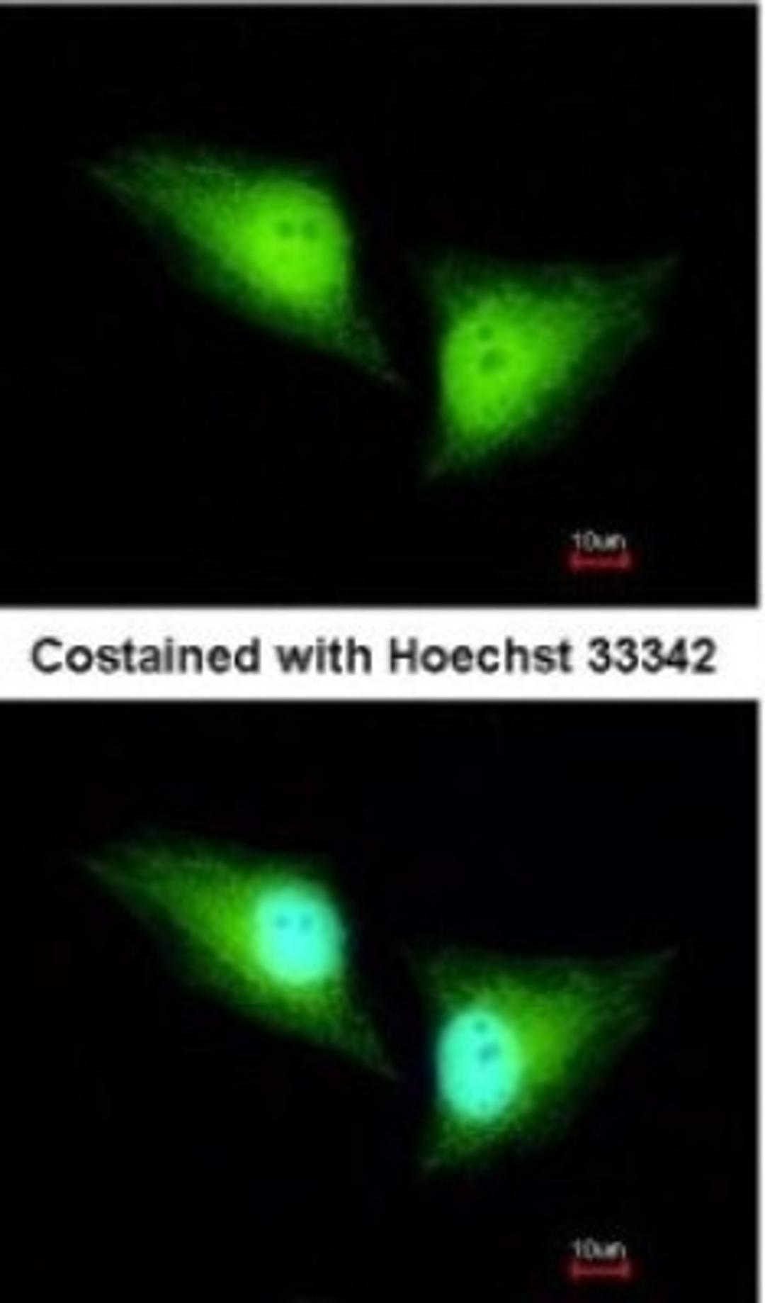 Immunocytochemistry/Immunofluorescence: ALDH7A1 Antibody [NBP2-15343] - Paraformaldehyde-fixed HeLa, using antibody at 1:200 dilution.