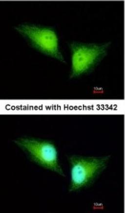 Immunocytochemistry/Immunofluorescence: ALDH7A1 Antibody [NBP2-15343] - Paraformaldehyde-fixed HeLa, using antibody at 1:200 dilution.