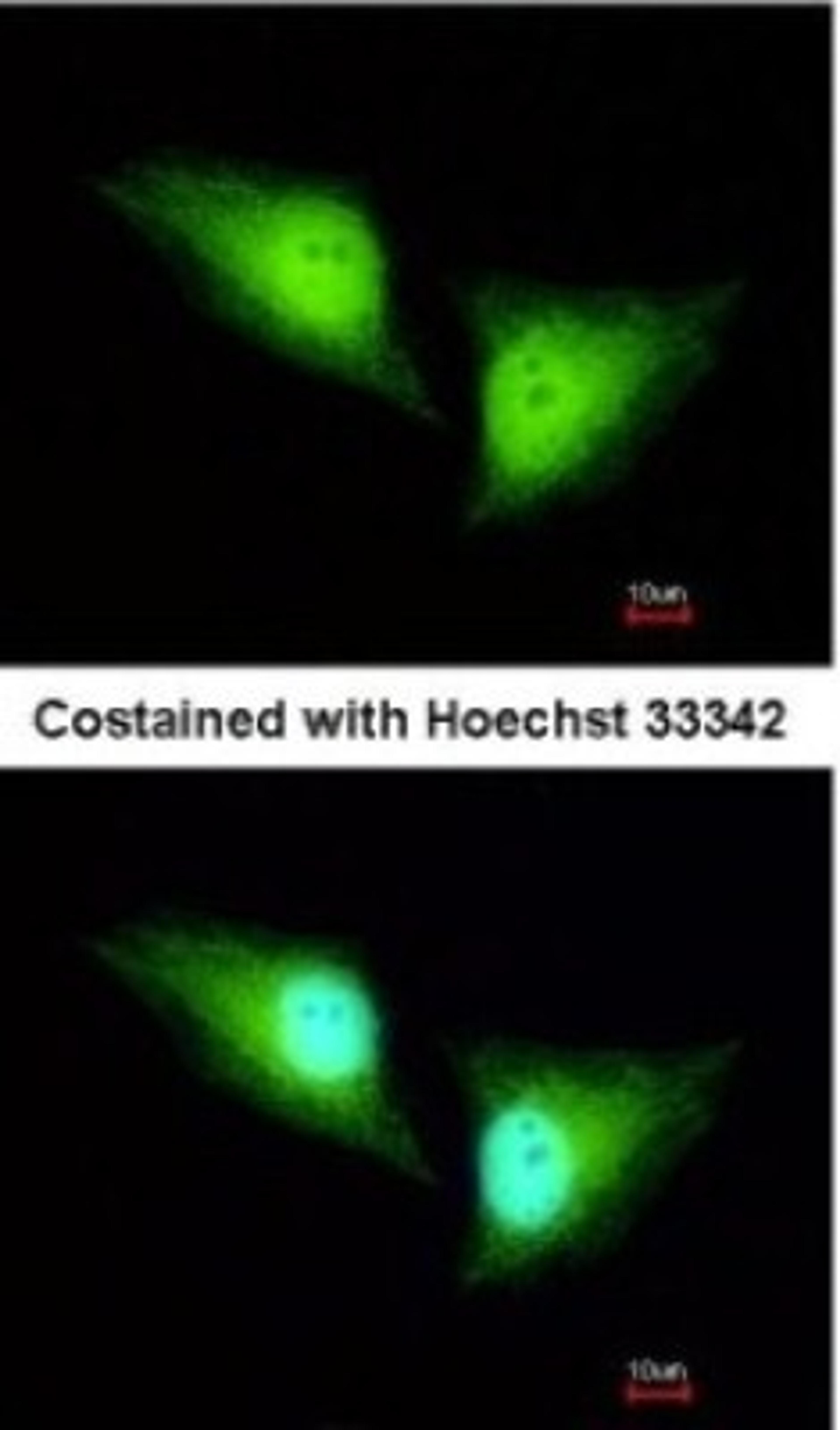 Immunocytochemistry/Immunofluorescence: ALDH7A1 Antibody [NBP2-15343] - Paraformaldehyde-fixed HeLa, using antibody at 1:200 dilution.