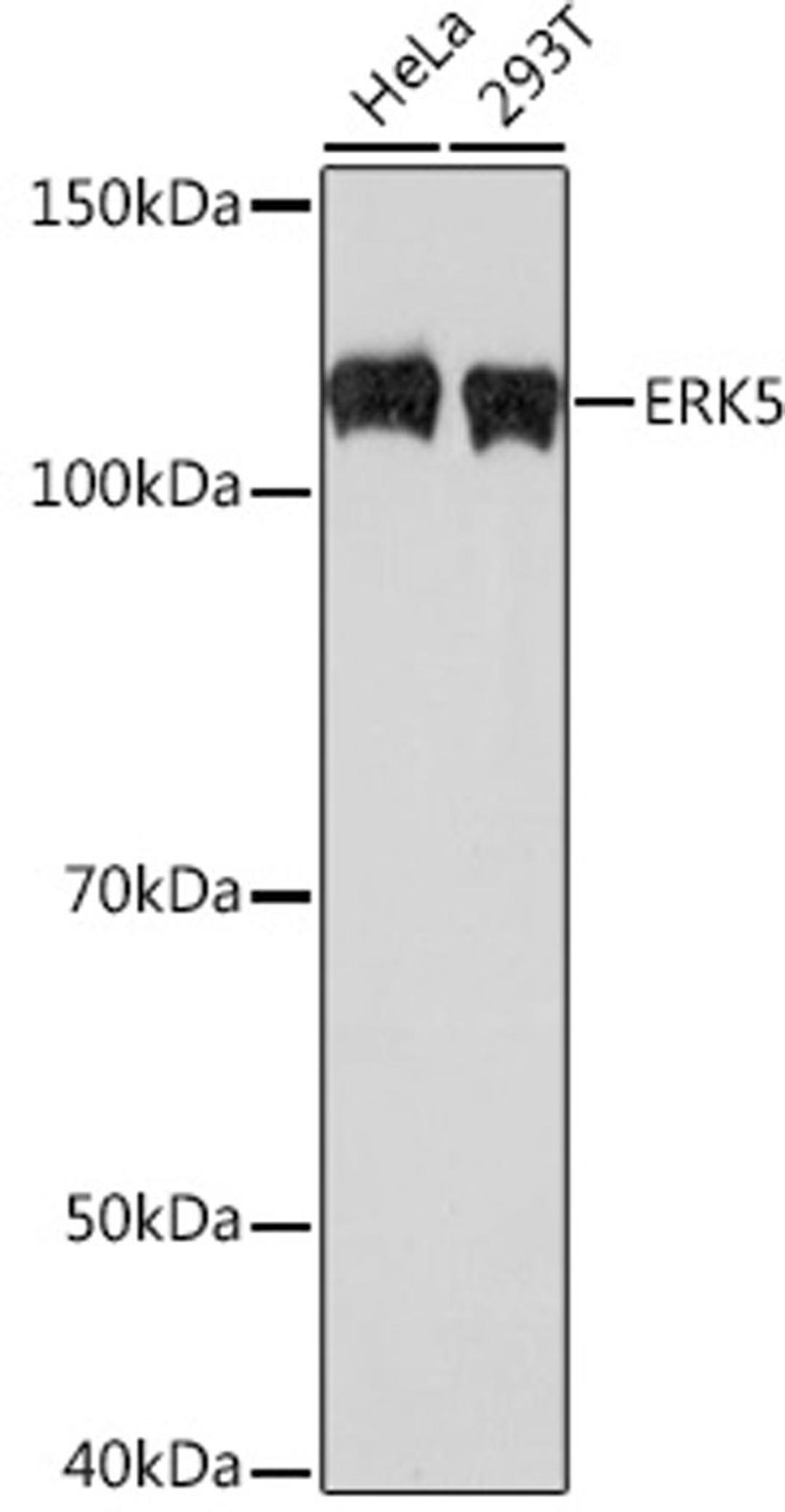 Western blot - ERK5 Rabbit mAb (A3948)