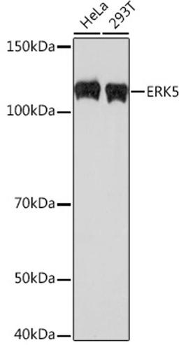 Western blot - ERK5 Rabbit mAb (A3948)