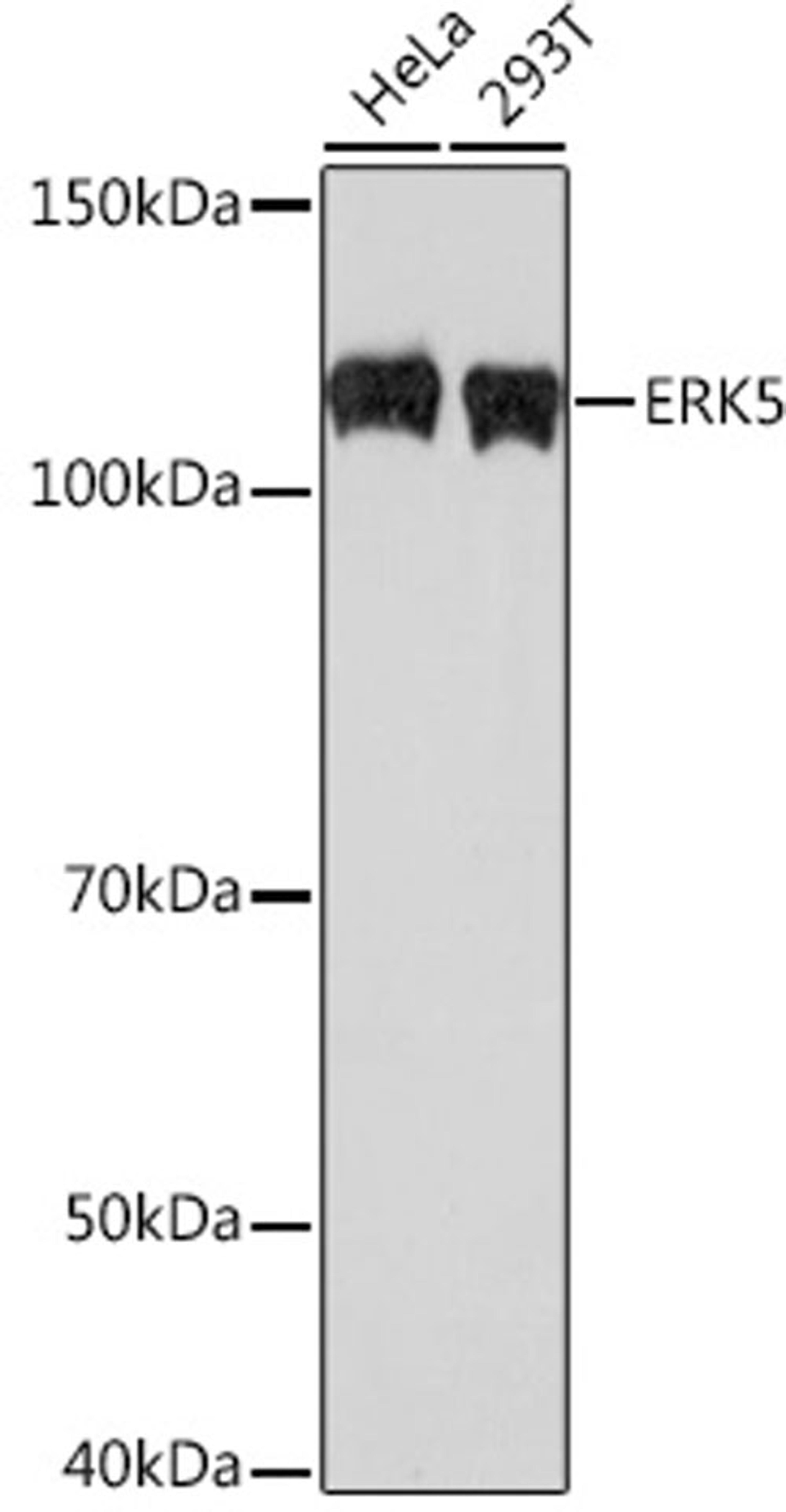 Western blot - ERK5 Rabbit mAb (A3948)