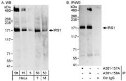 Detection of human and mouse IRS1 by western blot (h&m) and immunoprecipitation (h).