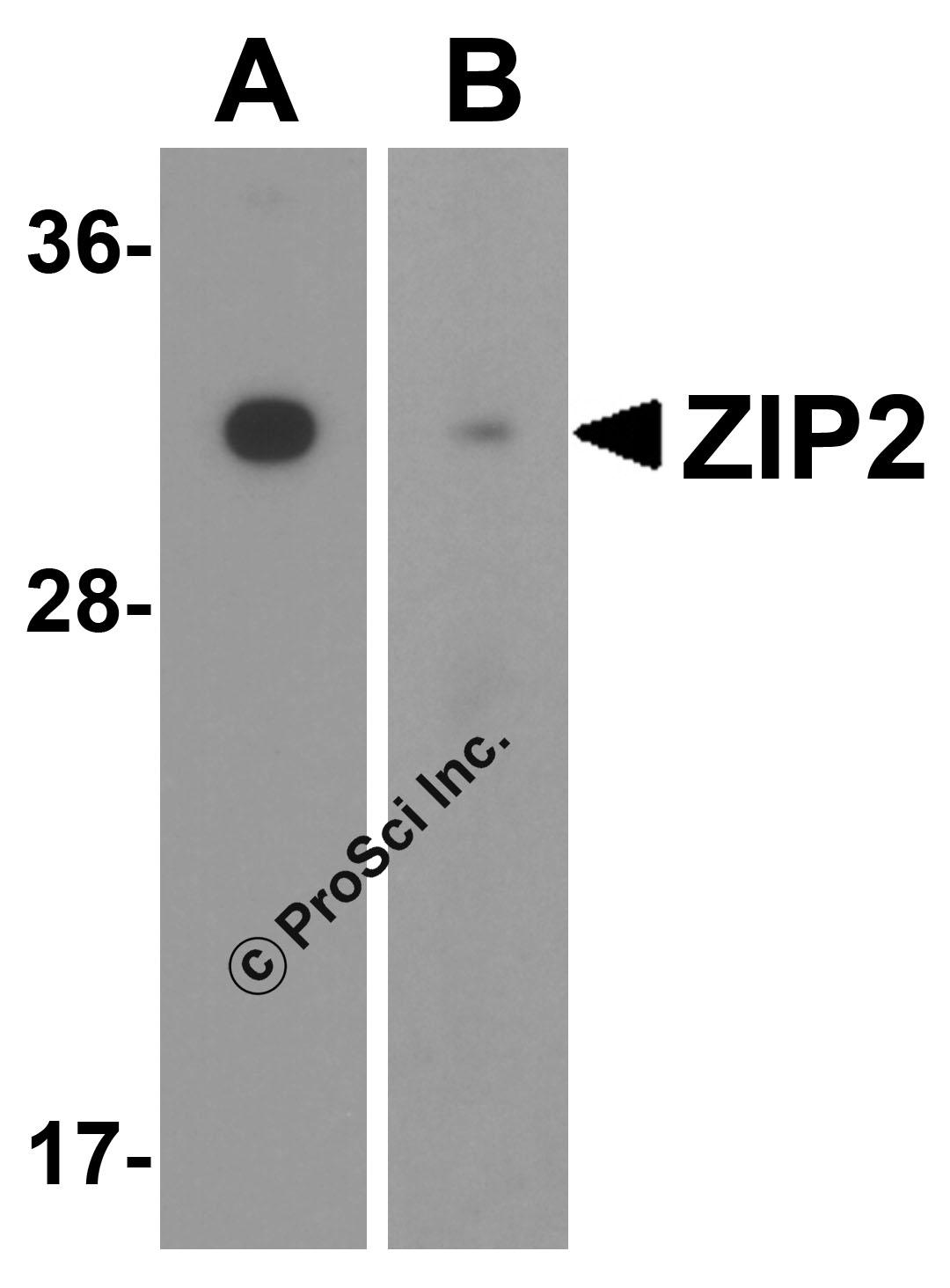 Western blot analysis of ZIP2 in (A) mouse and (B) rat brain tissue lysate with ZIP2 antibody at 1 μg/mL.