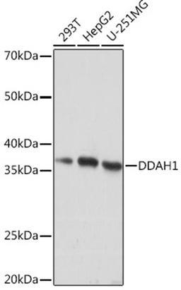 Western blot - DDAH1 Rabbit mAb (A4591)