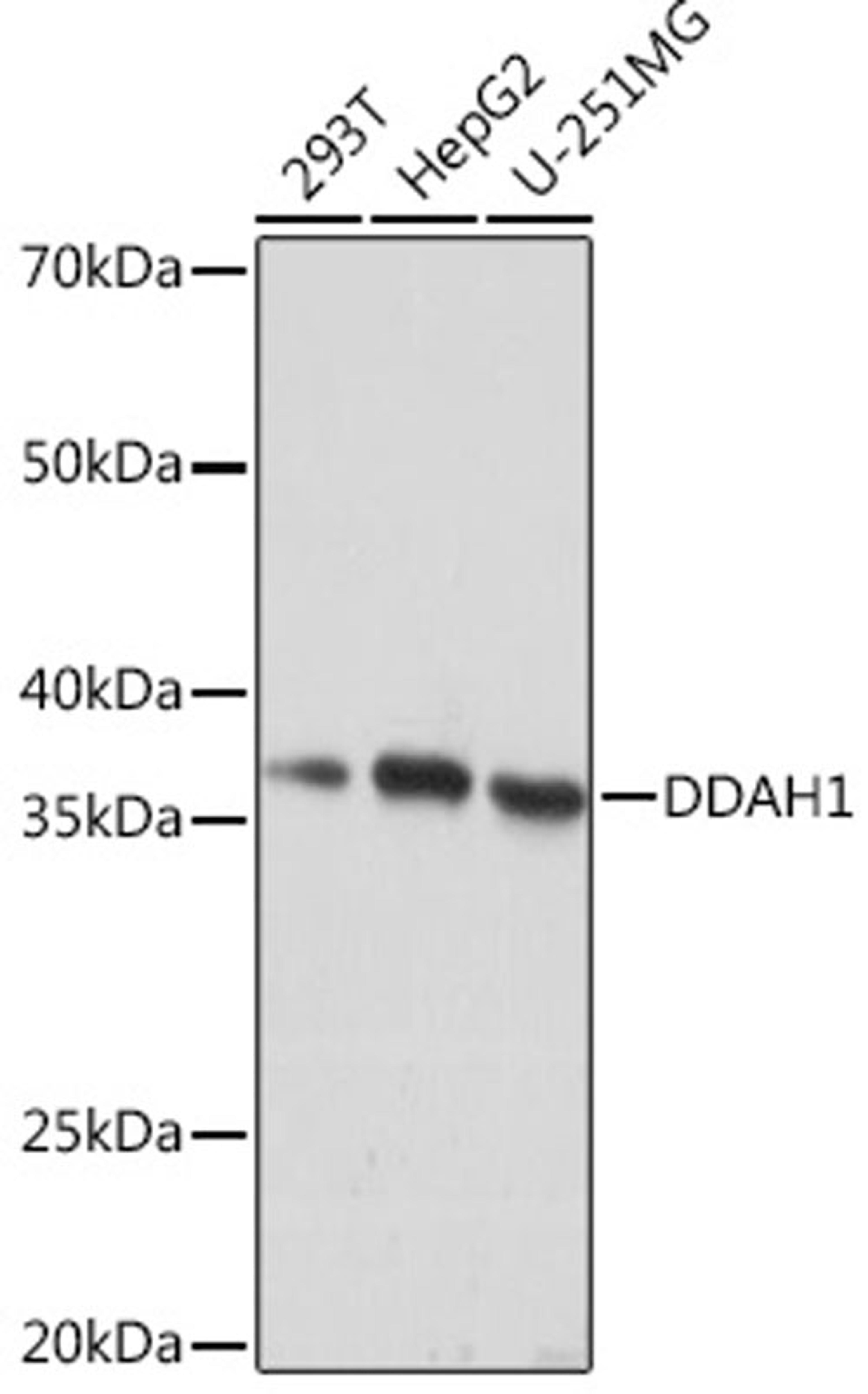 Western blot - DDAH1 Rabbit mAb (A4591)