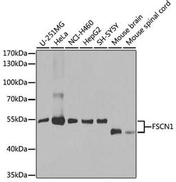 Western blot - FSCN1 antibody (A1904)