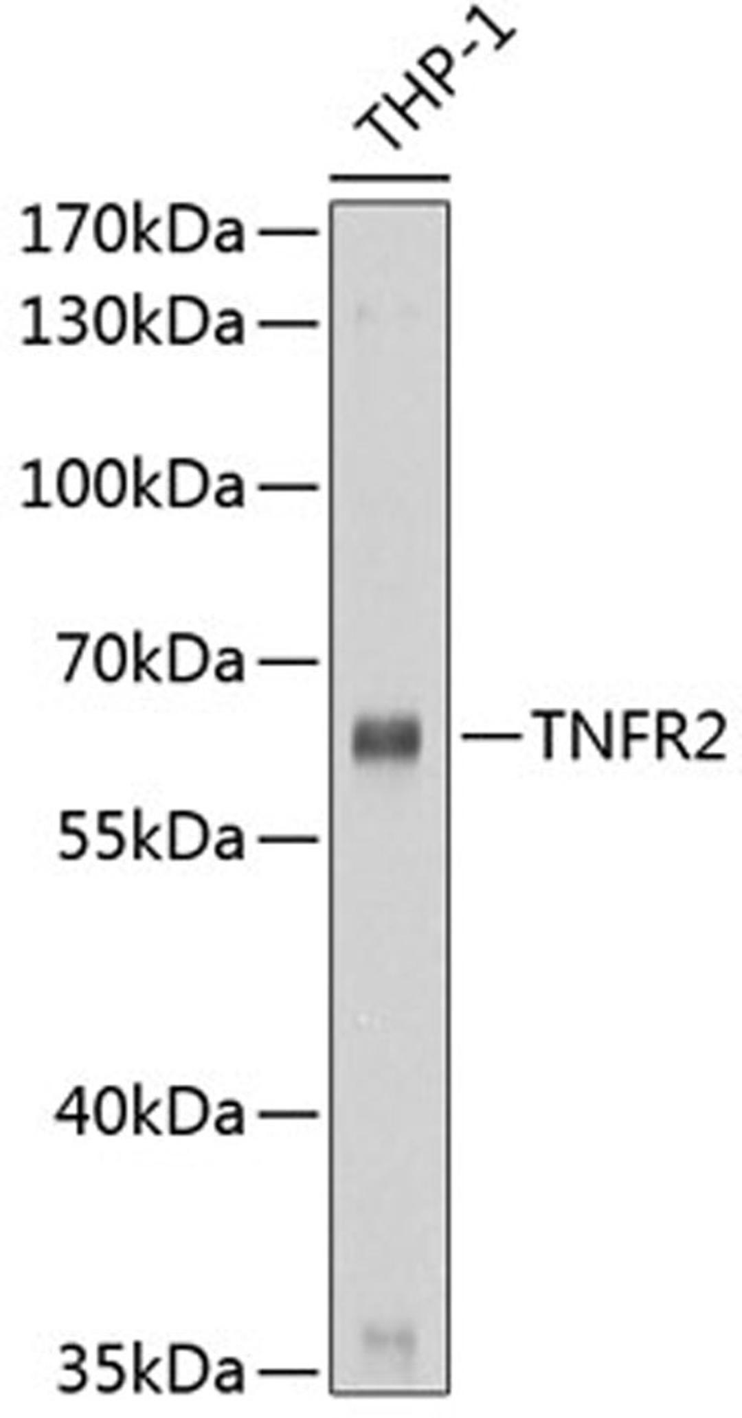 Western blot - TNFRSF1B antibody (A1095)