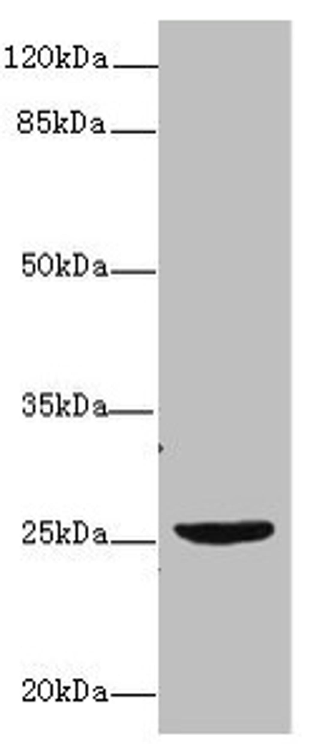 Western blot. All lanes: NEGR1 antibody at 4µg/ml + U87 whole cell lysate. Secondary. Goat polyclonal to rabbit IgG at 1/10000 dilution. Predicted band size: 39, 25 kDa. Observed band size: 25 kDa