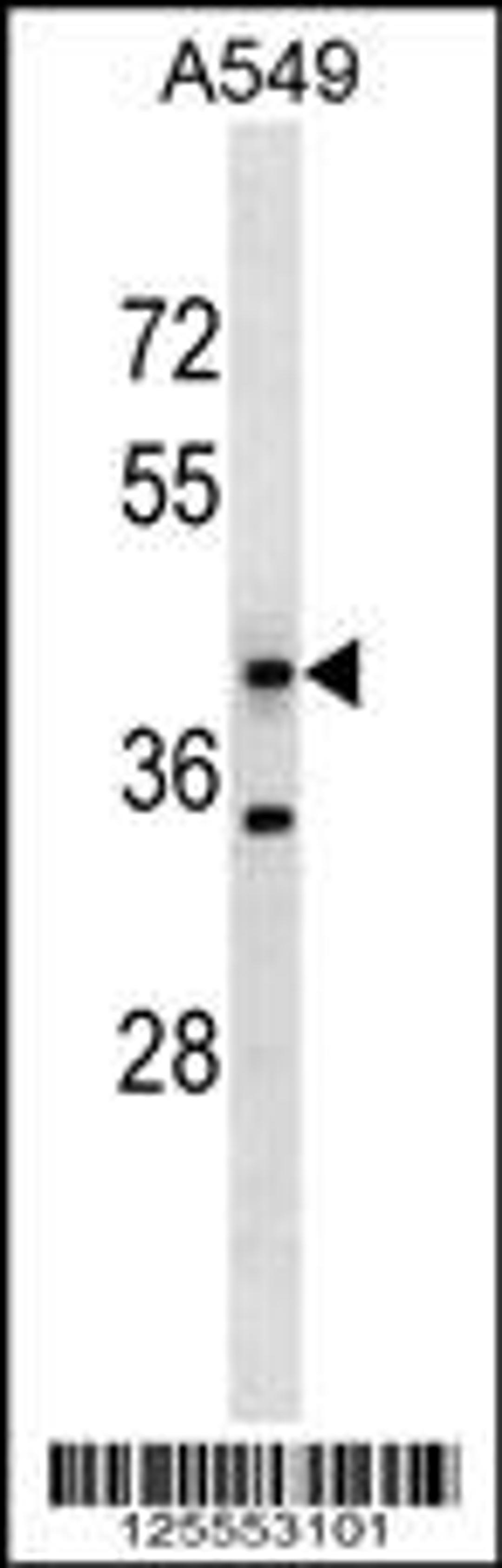 Western blot analysis in A549 cell line lysates (35ug/lane).