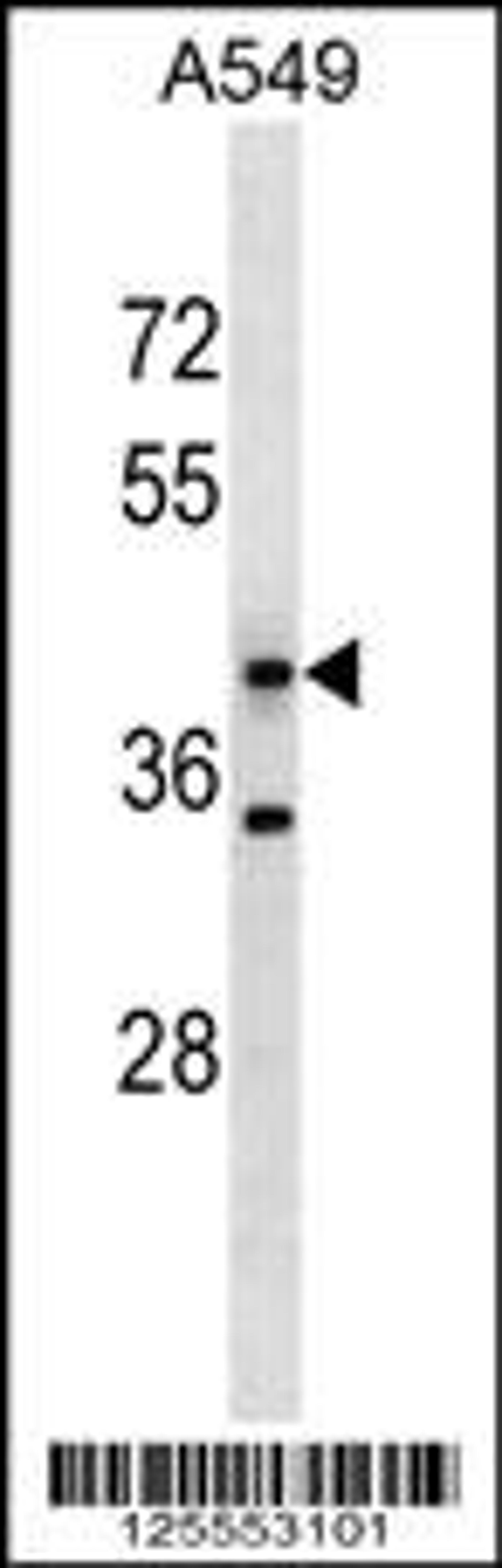 Western blot analysis in A549 cell line lysates (35ug/lane).