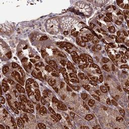 Immunohistochemistry-Paraffin: SLC15A5 Antibody [NBP2-14511] - Staining of human stomach, lower shows strong cytoplasmic positivity in glandular cells.