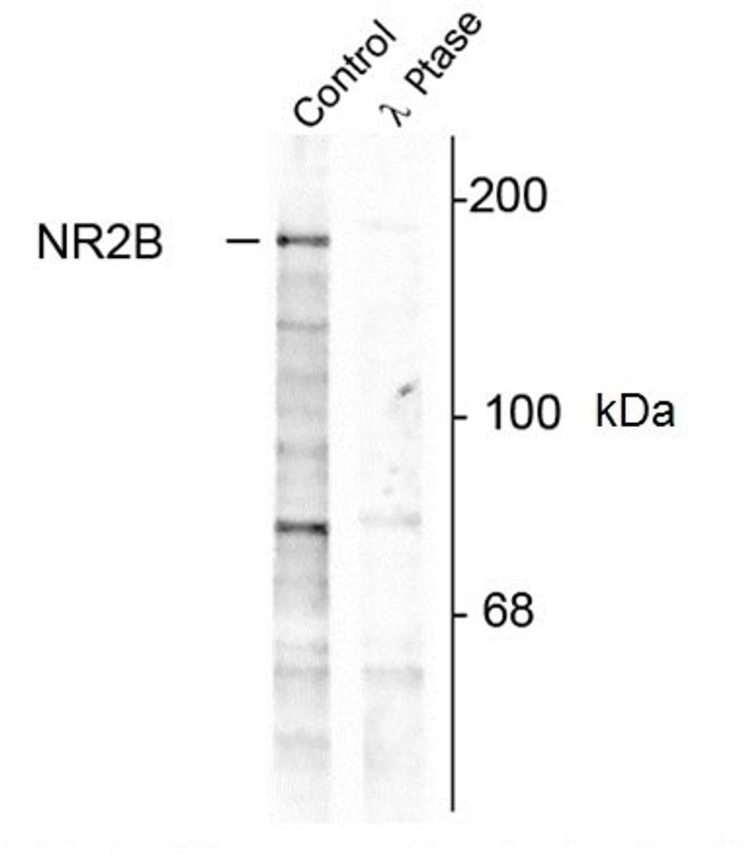 Western blot analysis of rat hippocampal lysate