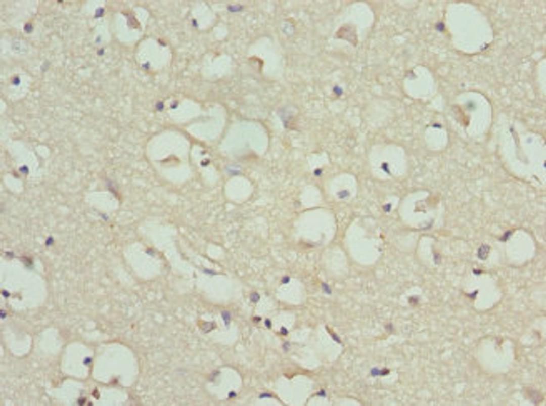 Immunohistochemistry of paraffin-embedded human brain tissue using CSB-PA10065A0Rb at dilution of 1:100