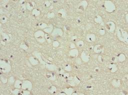 Immunohistochemistry of paraffin-embedded human brain tissue using CSB-PA10065A0Rb at dilution of 1:100