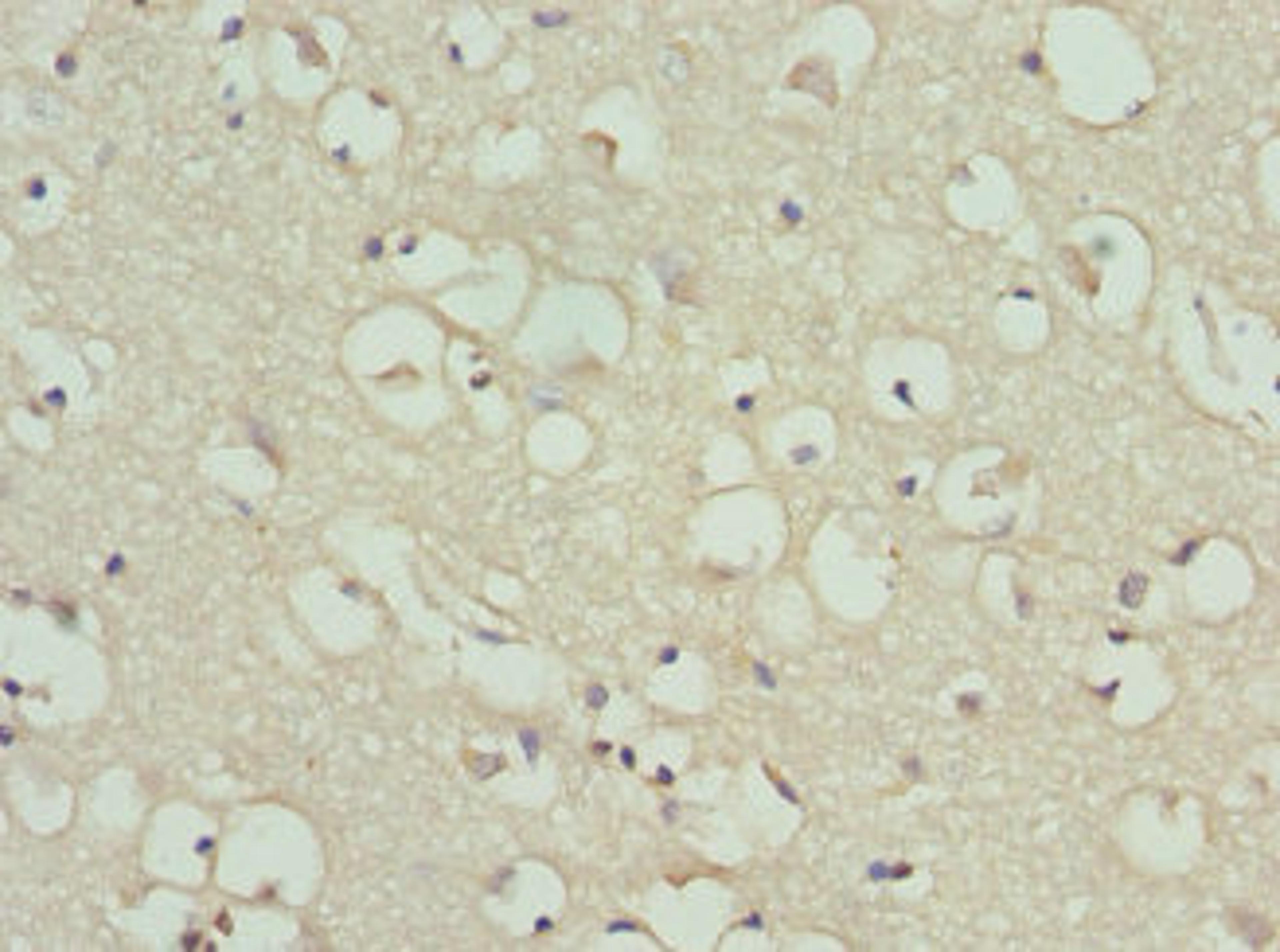 Immunohistochemistry of paraffin-embedded human brain tissue using CSB-PA10065A0Rb at dilution of 1:100