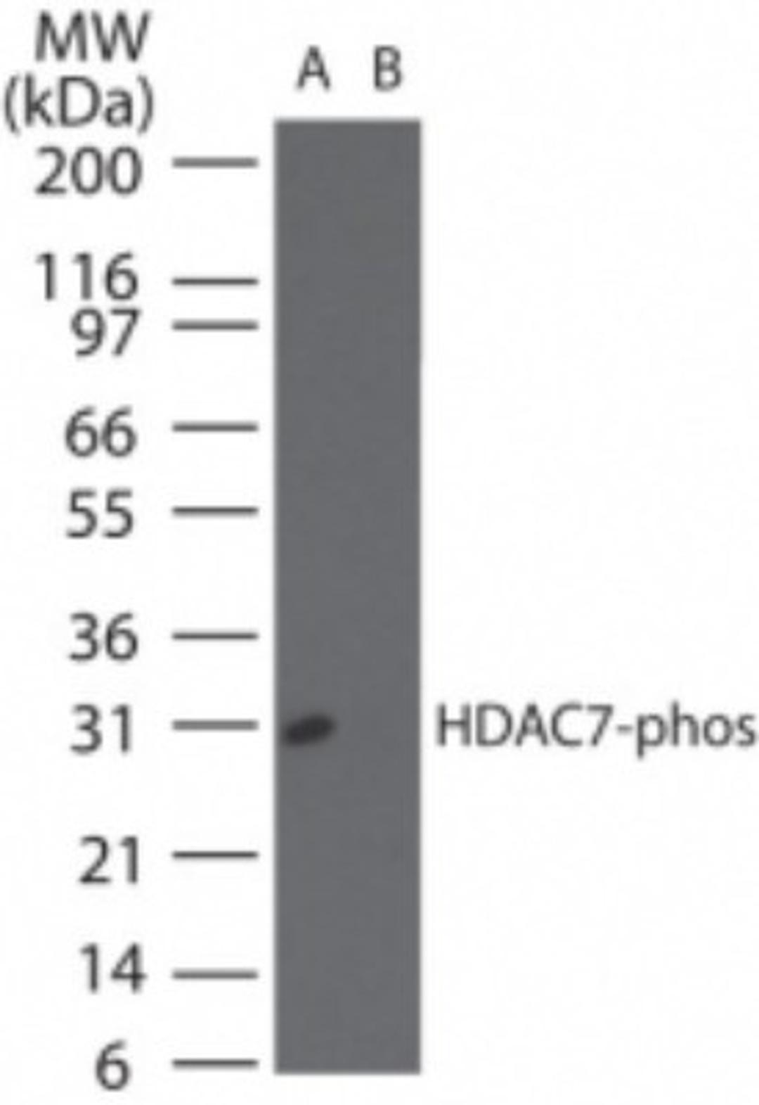 Western Blot: HDAC9 [p Ser155] Antibody [NBP2-24454] - Western blot analysis of phosphorylated HDAC9 in (A) recombinant fusion protein containing a phosphorylated serine at position155and (B) fusion protein containinugan unphosphorylated serine at position 155, using NBP2-24454 at 0.1 ug/ml.