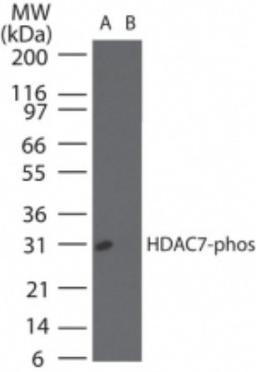 Western Blot: HDAC9 [p Ser155] Antibody [NBP2-24454] - Western blot analysis of phosphorylated HDAC9 in (A) recombinant fusion protein containing a phosphorylated serine at position155and (B) fusion protein containinugan unphosphorylated serine at position 155, using NBP2-24454 at 0.1 ug/ml.