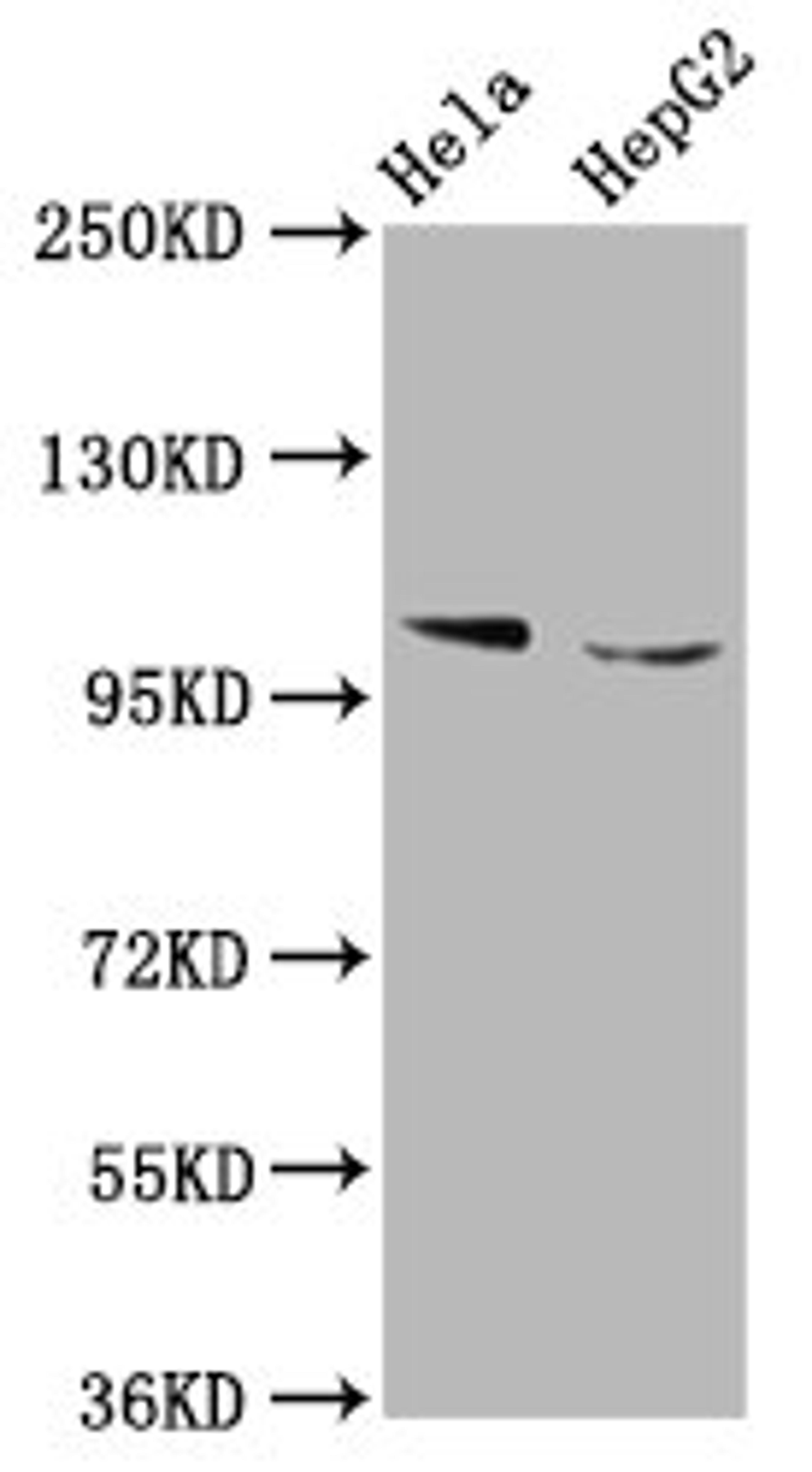 Western Blot. Positive WB detected in: Hela whole cell lysate, HepG2 whole cell lysate. All lanes: IKBKAP antibody at 5.3ug/ml. Secondary. Goat polyclonal to rabbit IgG at 1/50000 dilution. Predicted band size: 151 kDa. Observed band size: 151 kDa.