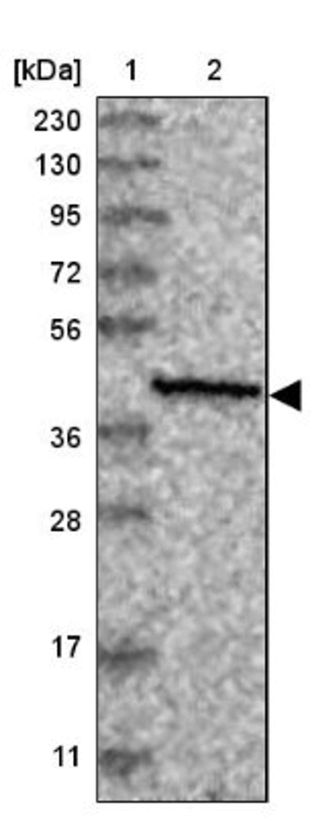 Immunohistochemistry: SLC9B1 Antibody [NBP1-90664] - Lane 1: Marker [kDa] 230, 130, 95, 72, 56, 36, 28, 17, 11<br/>Lane 2: Human cell line RT-4