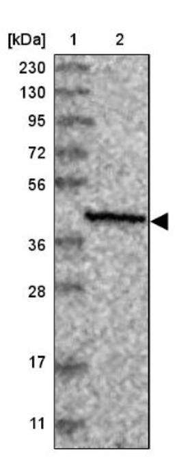 Immunohistochemistry: SLC9B1 Antibody [NBP1-90664] - Lane 1: Marker [kDa] 230, 130, 95, 72, 56, 36, 28, 17, 11<br/>Lane 2: Human cell line RT-4