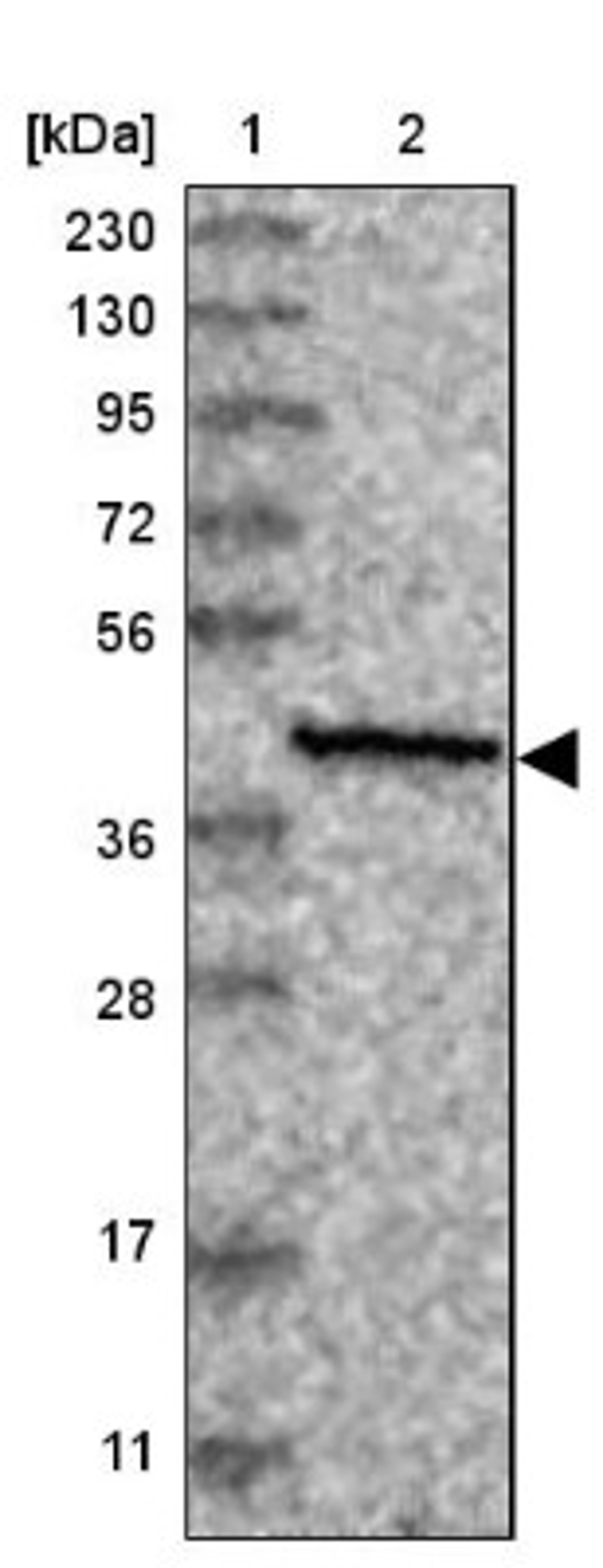 Immunohistochemistry: SLC9B1 Antibody [NBP1-90664] - Lane 1: Marker [kDa] 230, 130, 95, 72, 56, 36, 28, 17, 11<br/>Lane 2: Human cell line RT-4