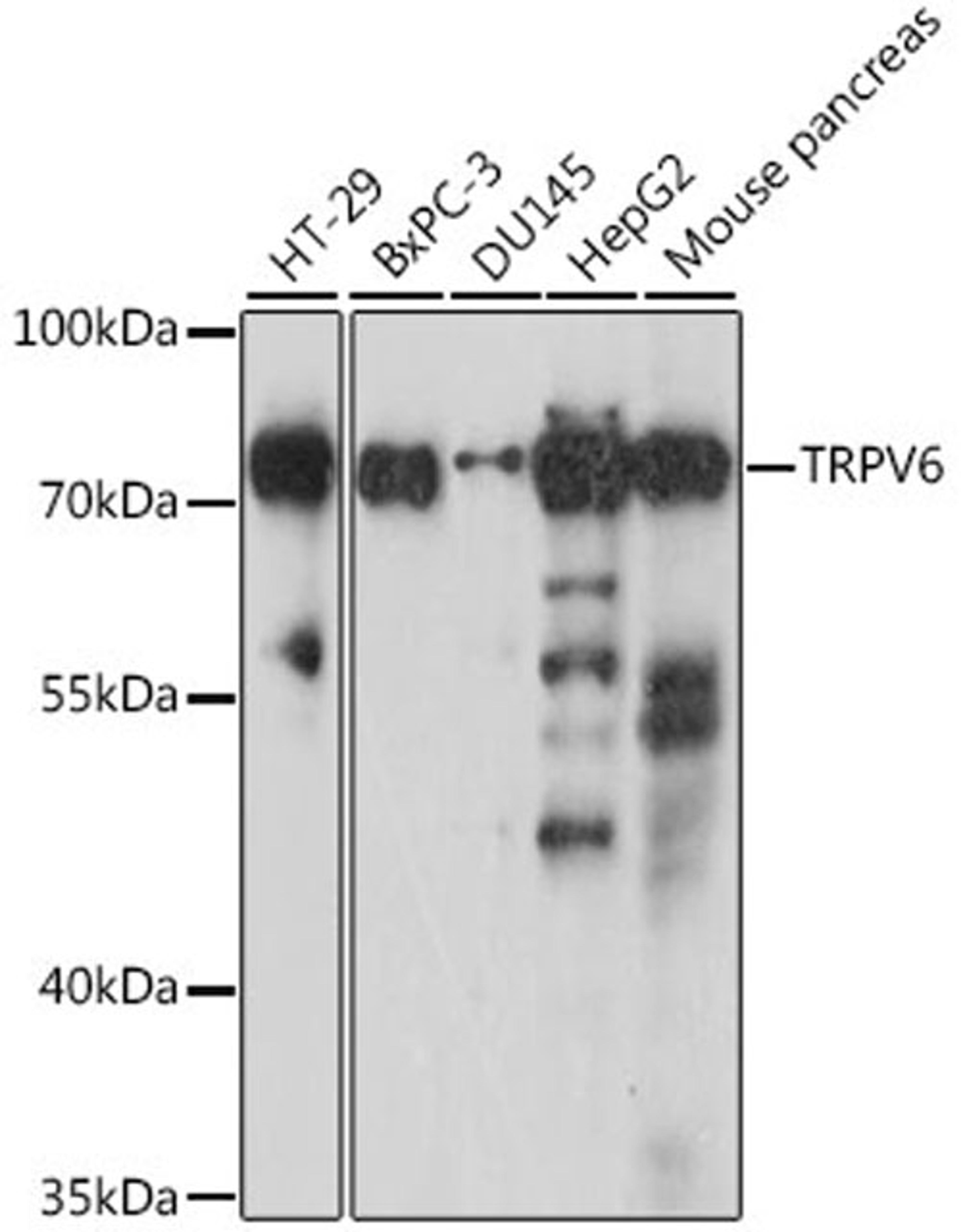 Western blot - TRPV6 antibody (A16128)