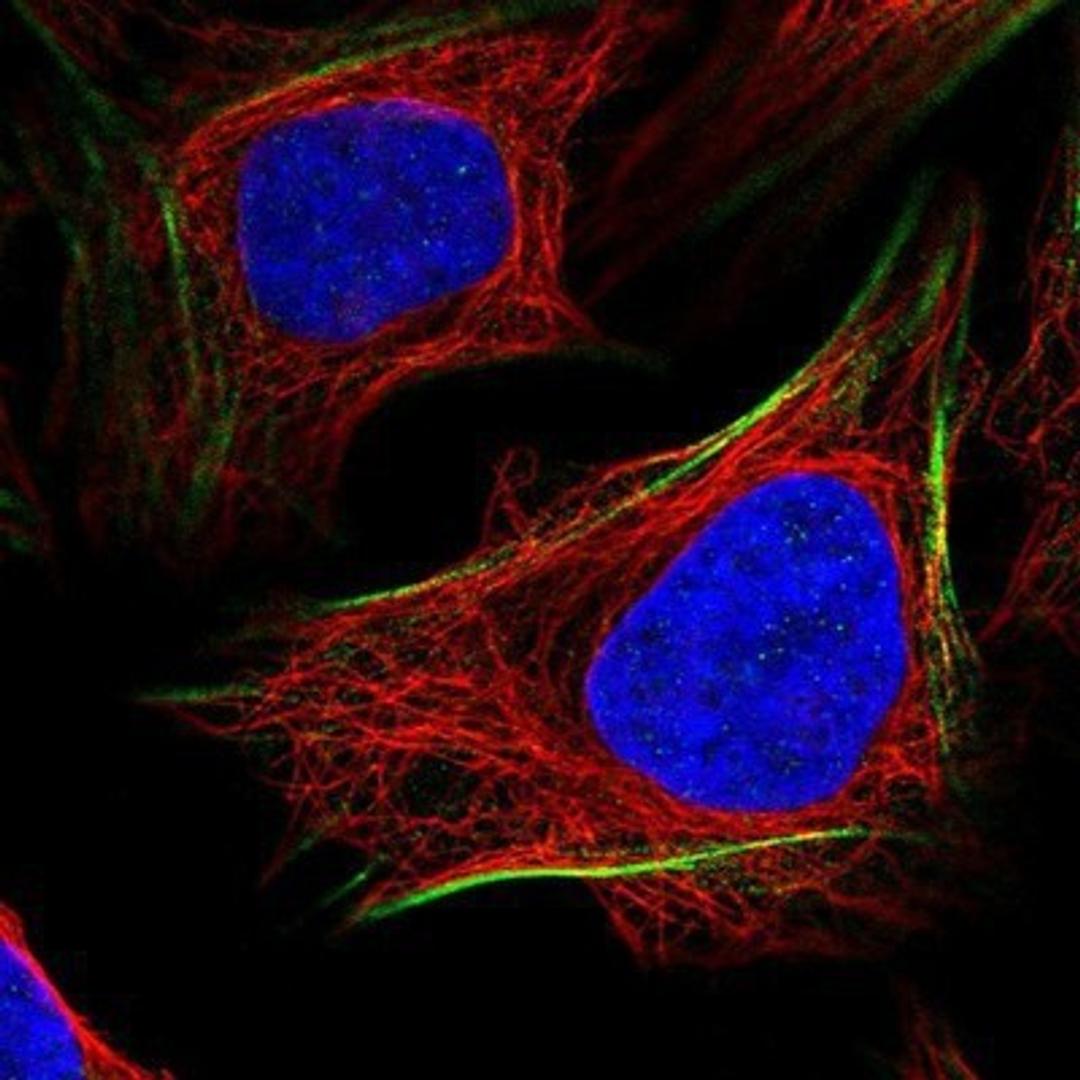 Immunocytochemistry/Immunofluorescence: PGM1 Antibody [NBP1-85977] - Staining of human cell line U-2 OS shows positivity in cytoskeleton (actin filaments).