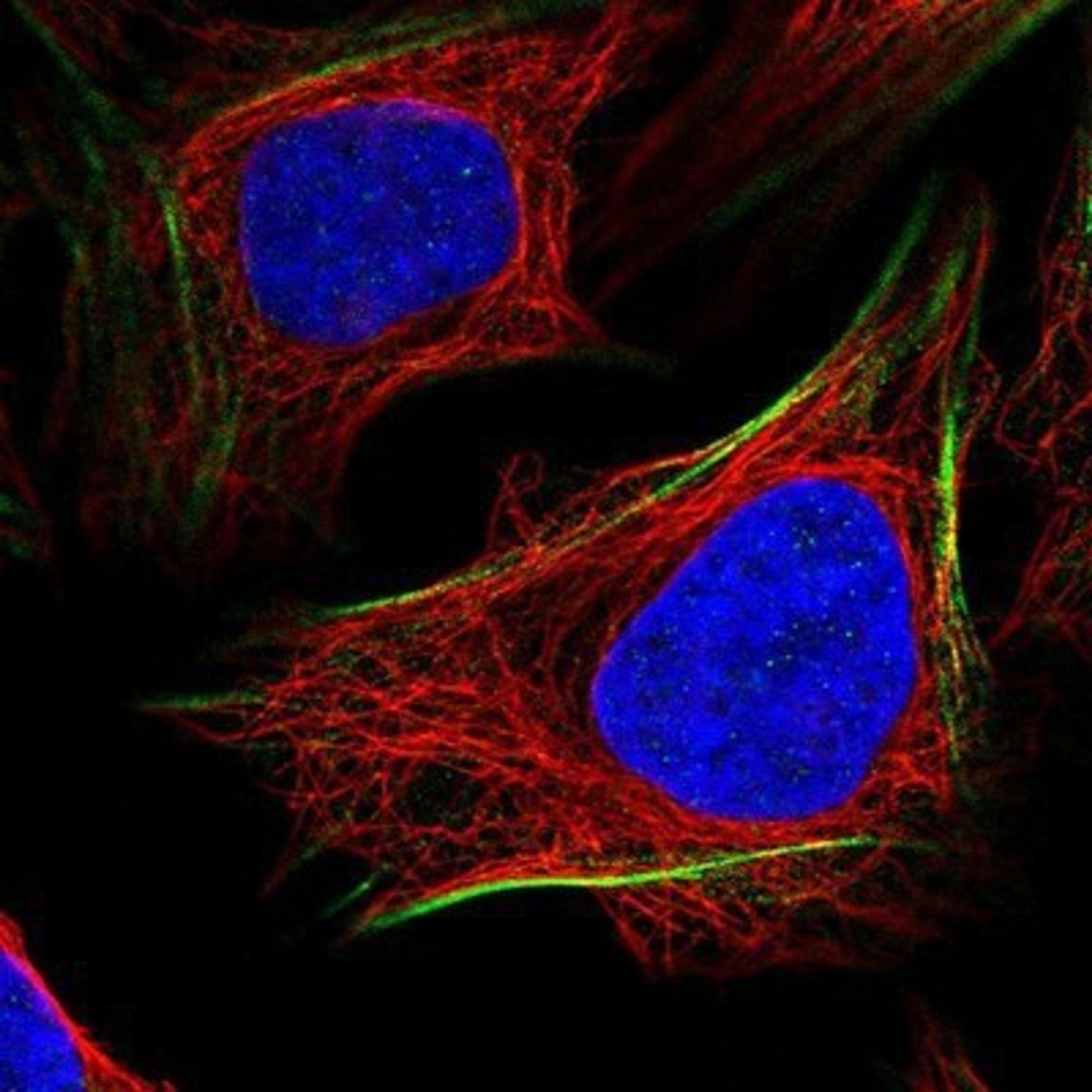 Immunocytochemistry/Immunofluorescence: PGM1 Antibody [NBP1-85977] - Staining of human cell line U-2 OS shows positivity in cytoskeleton (actin filaments).