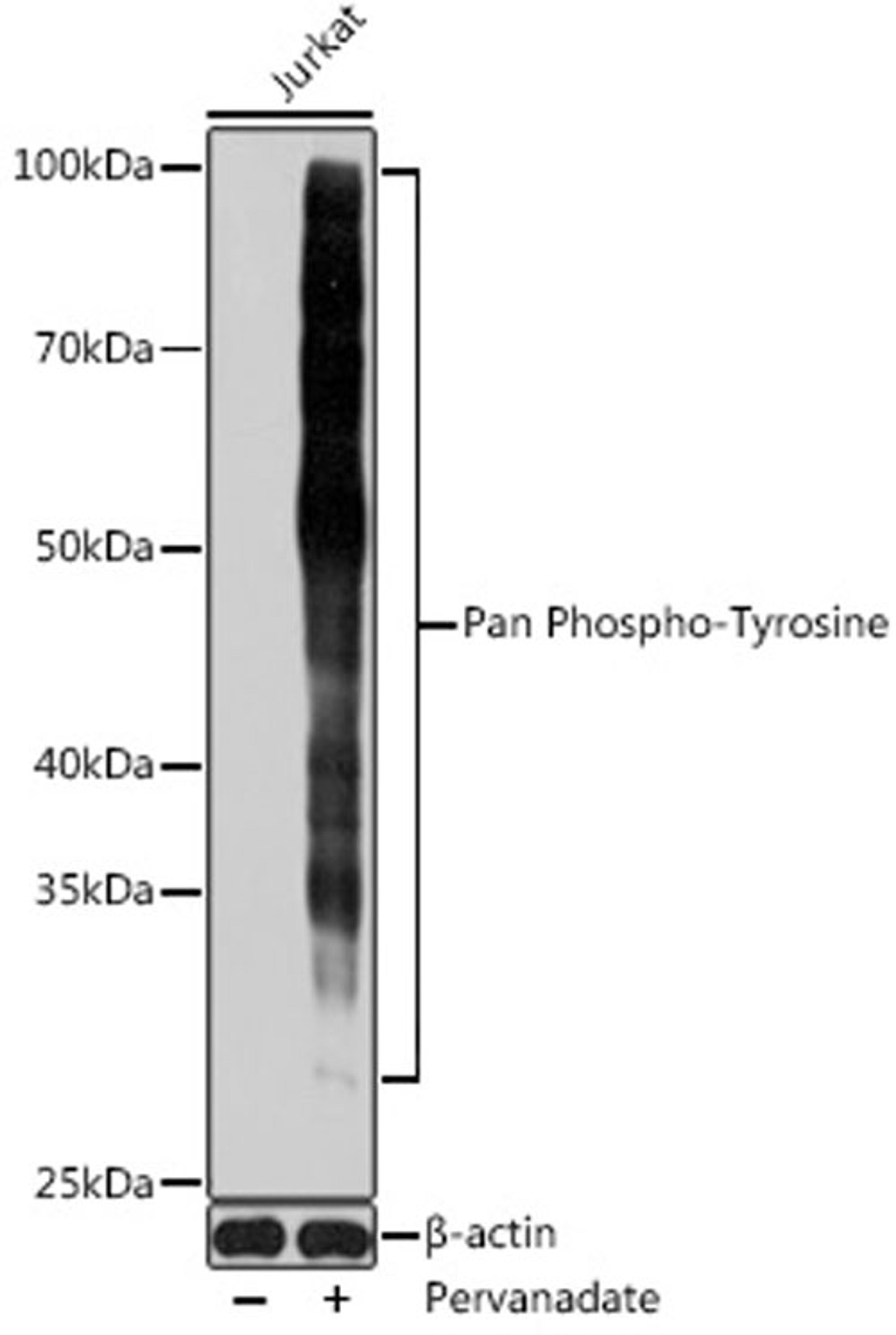 Western blot - Pan Phospho-Tyrosine antibody (AP0973)