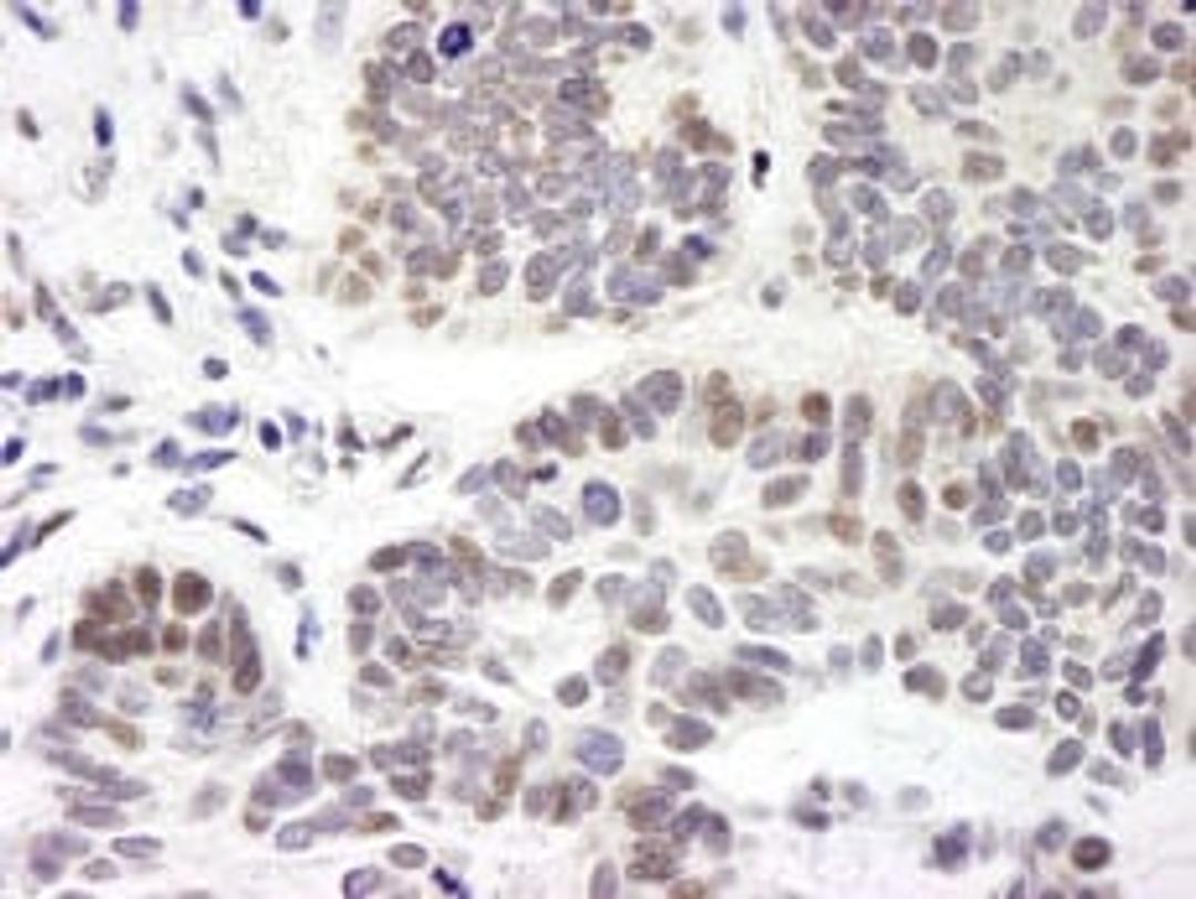 Detection of human ZNF261 by immunohistochemistry.