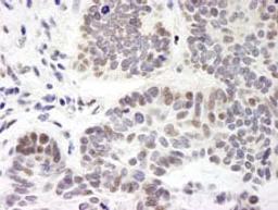 Detection of human ZNF261 by immunohistochemistry.