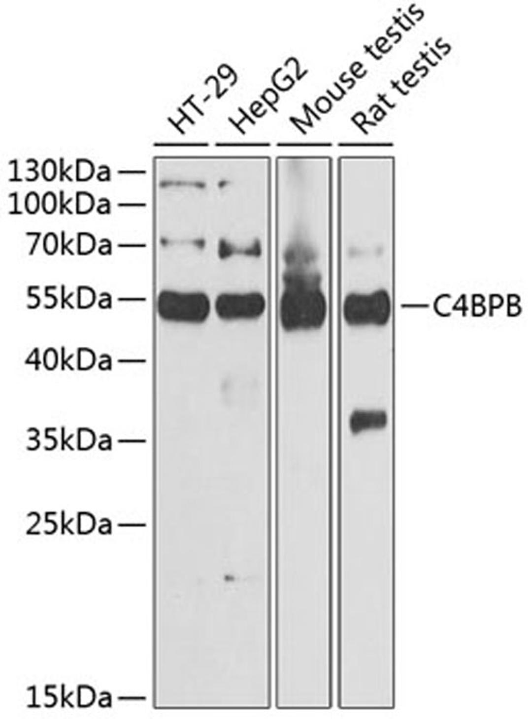 Western blot - C4BPB antibody (A6362)