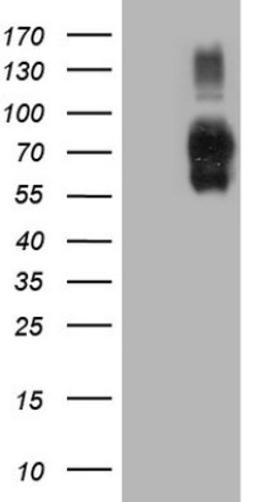 Western Blot: B7-H2/ICOSLG Antibody (2C5) [NBP2-46011] - Analysis of HEK293T cells were transfected with the pCMV6-ENTRY control (Left lane) or pCMV6-ENTRY ICOSLG.