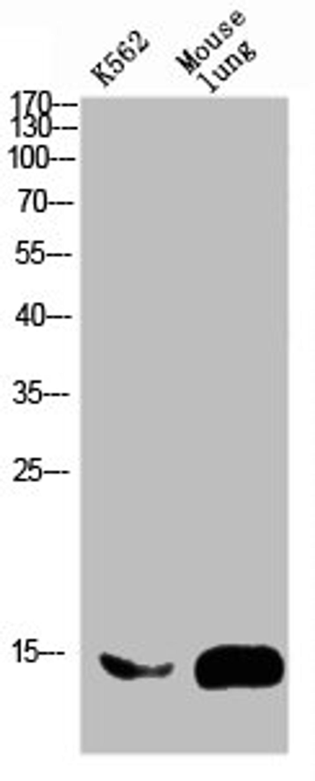Western blot analysis of mouse-brain mouse-spinal-cord lysate, antibody was diluted at 2000. Secondary antibody  was diluted at 1:20000