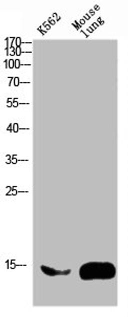 Western blot analysis of mouse-brain mouse-spinal-cord lysate, antibody was diluted at 2000. Secondary antibody  was diluted at 1:20000
